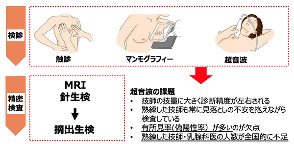 乳がんの健診プロセス