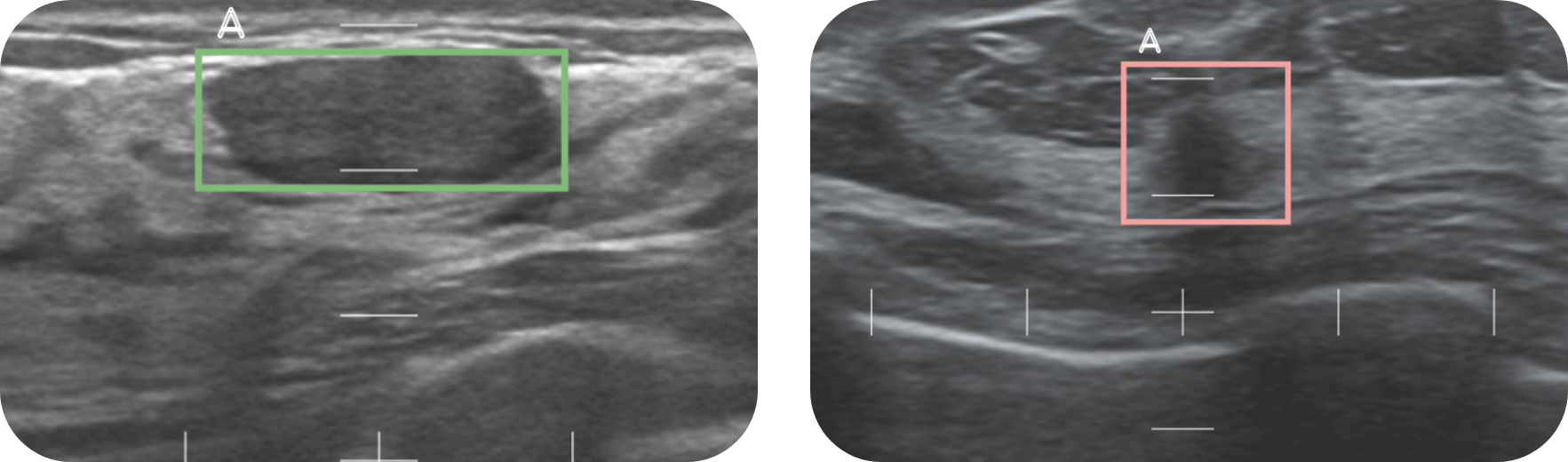 If the necessity of a detailed examination is suspected, it is indicated by a red box; if not, by a green box.